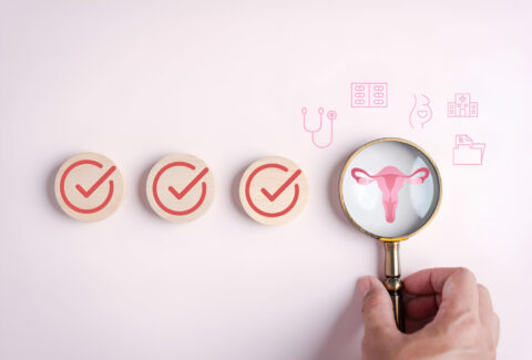 cure PCOS