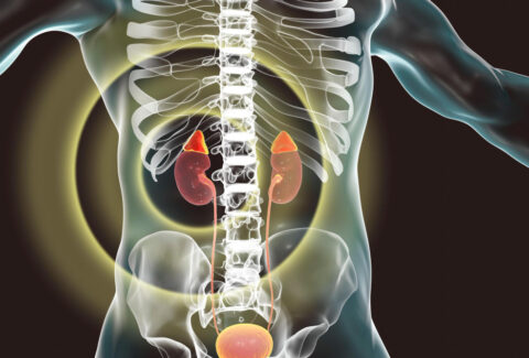 Chronic Kidney Disease