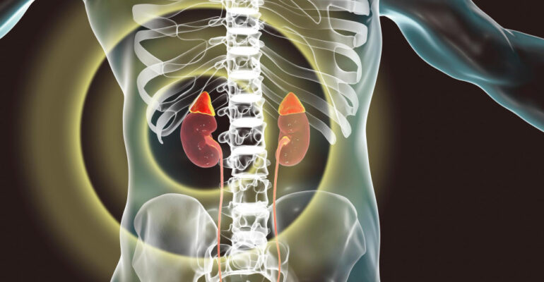 Chronic Kidney Disease
