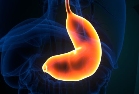 Treat Gastric Issues