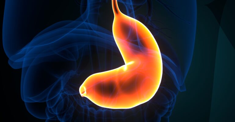 Treat Gastric Issues