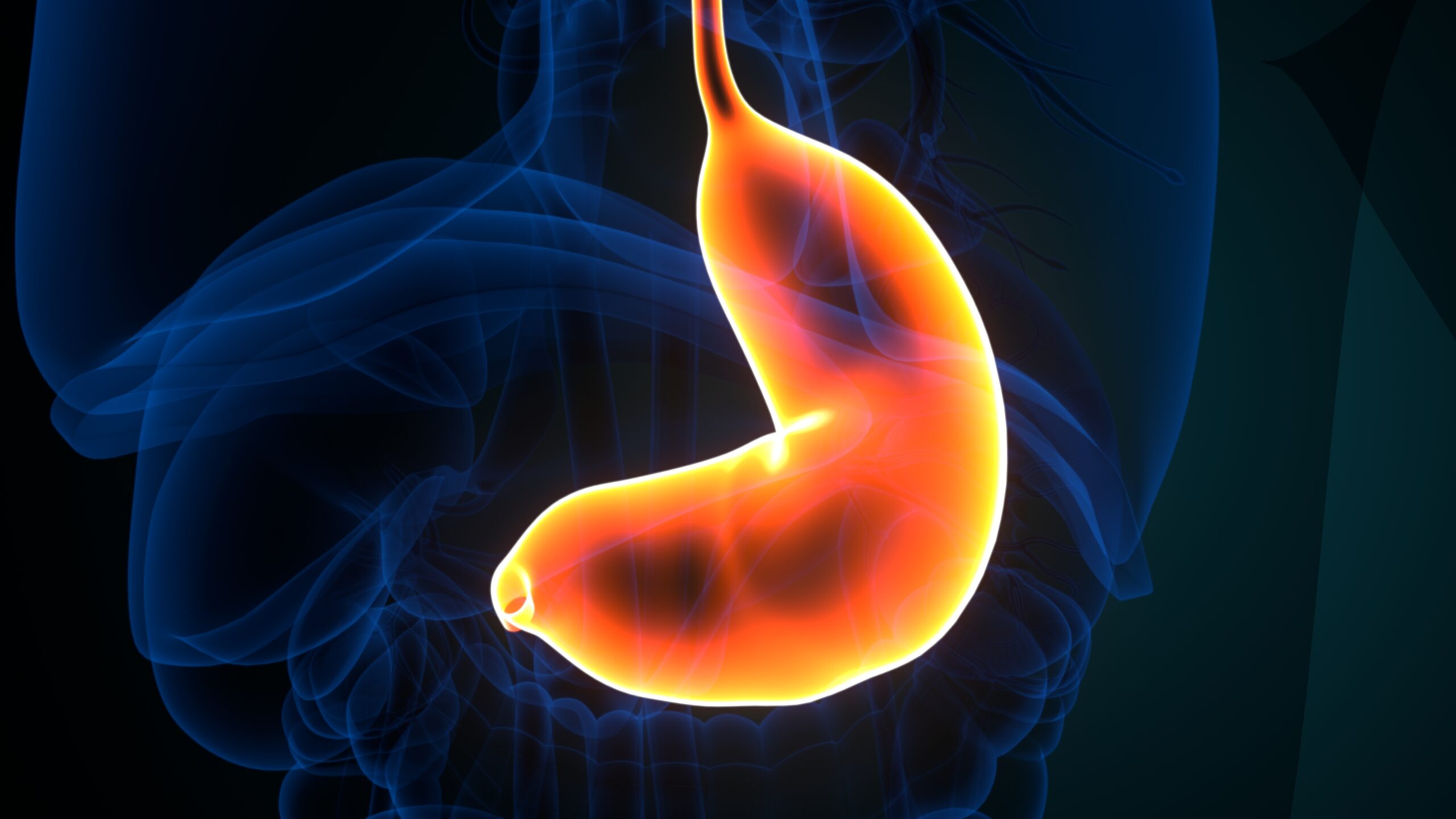 Treat Gastric Issues