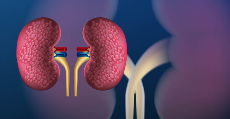 Kidney Disease