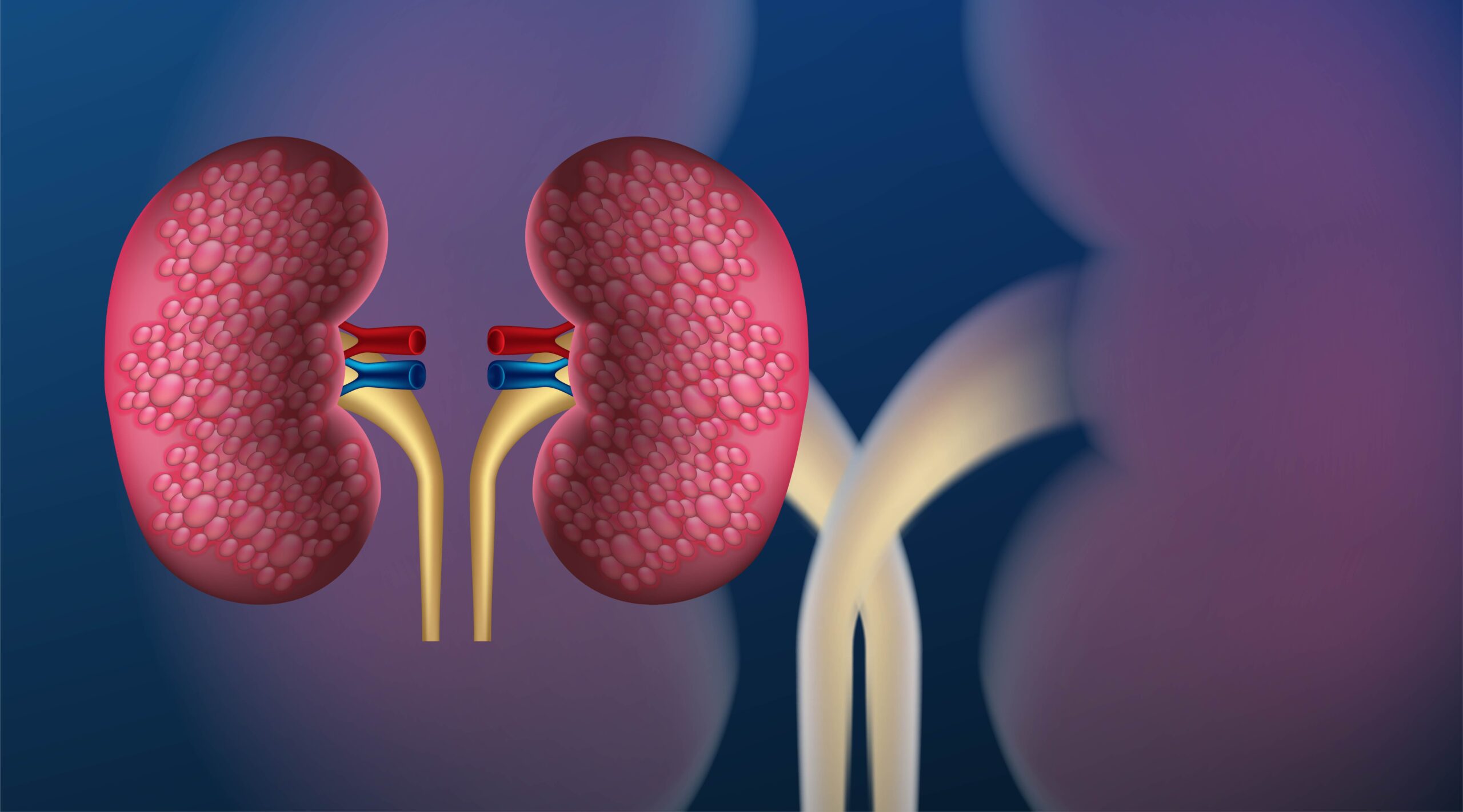 Kidney Disease
