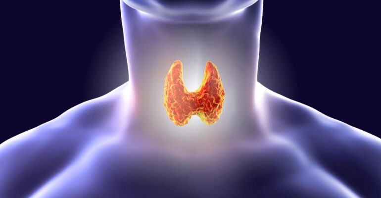 Thyroid Reversal
