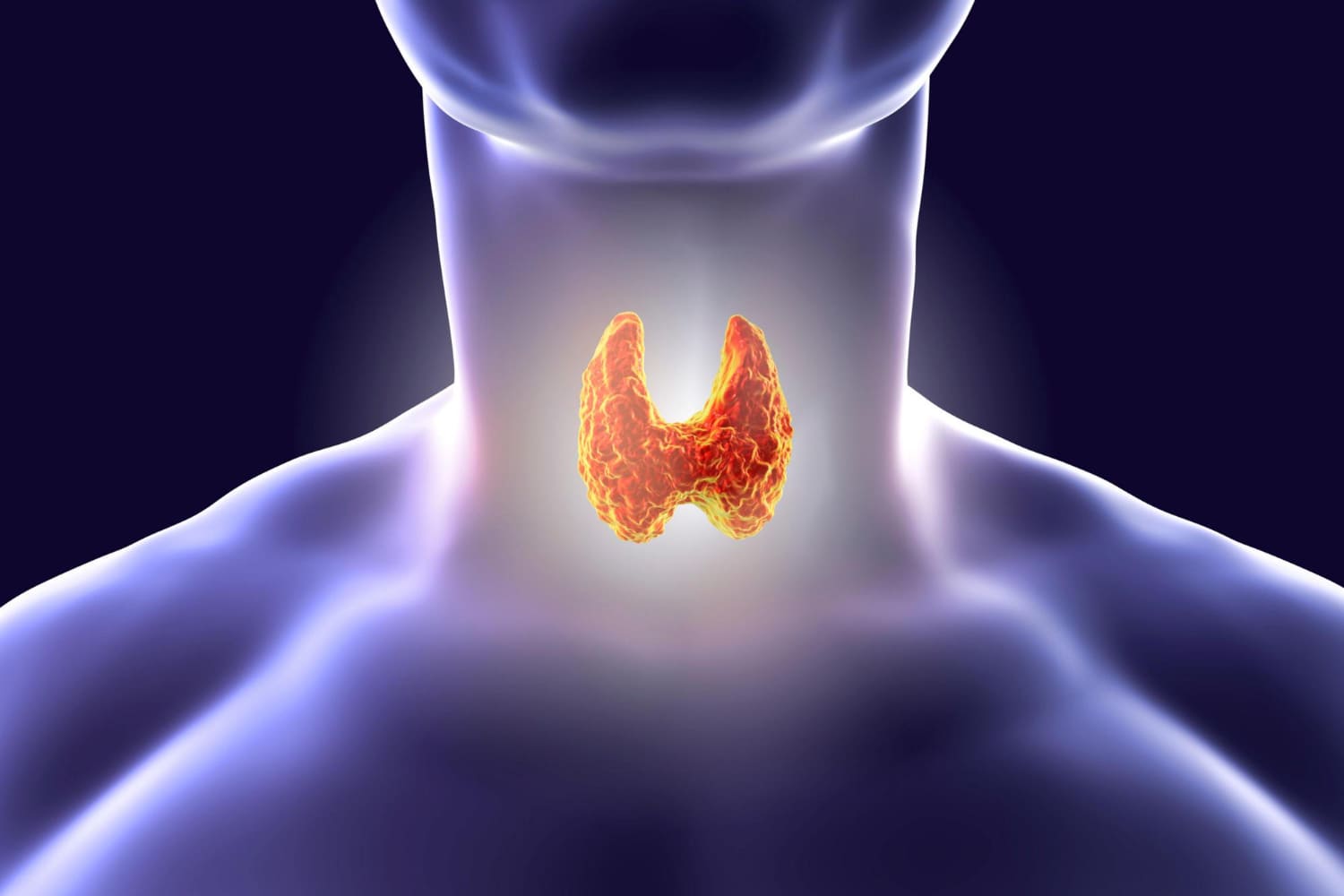 Thyroid Reversal